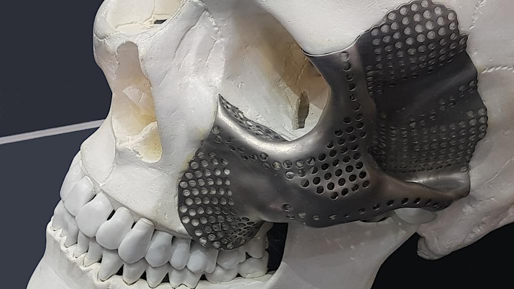 The Revolutionary Impact of 3D Printing in Medical Applications - TechNast